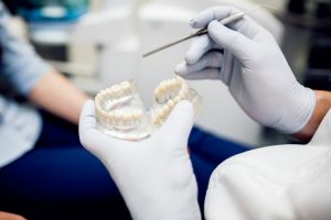 Impianto dentale singolo: quando e perché sceglierlo